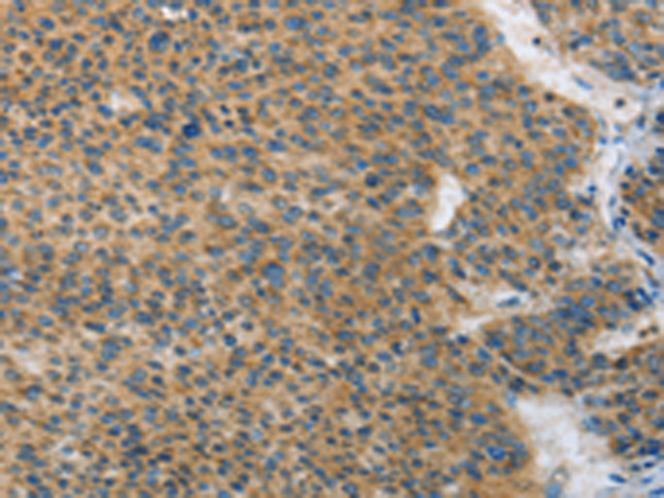 ANAPC13
