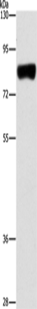 ARHGAP25