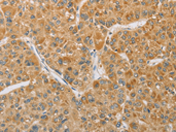 Rabbit Polyclonal Antibody to ARHGEF1