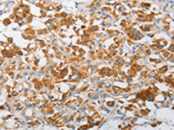 Rabbit Polyclonal Antibody to ARHGEF9