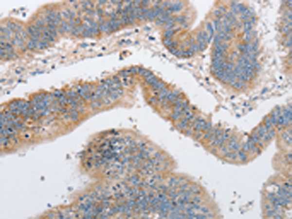 Rabbit Polyclonal Antibody to ARHGEF9