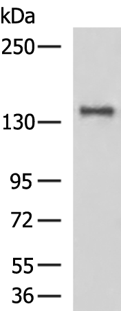FLT3