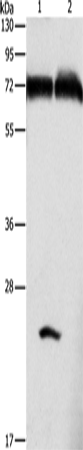 GDPD5