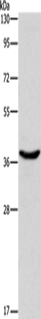 DNAJB1