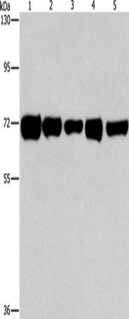 RPN1