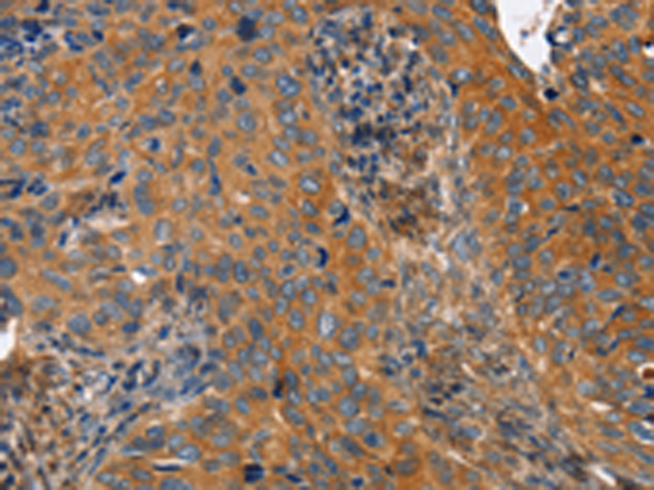 Rabbit Polyclonal Antibody to MAPK15
