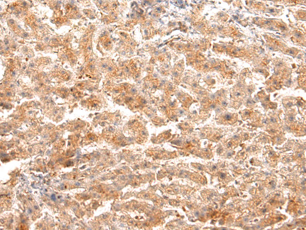 Rabbit Polyclonal Antibody to LTF