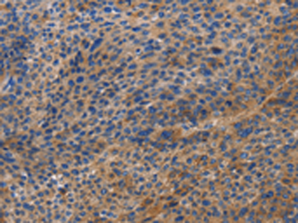 Rabbit Polyclonal Antibody to DOK4