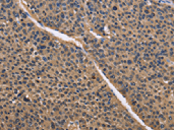 Rabbit Polyclonal Antibody to IDH1
