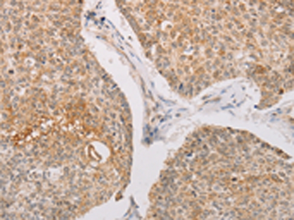 Rabbit Polyclonal Antibody to STK40