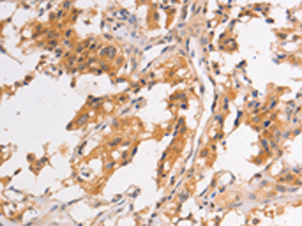 Rabbit Polyclonal Antibody to PIP5K1A