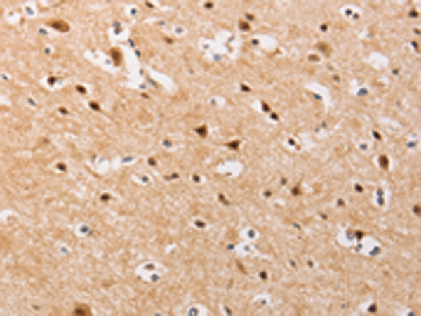 Rabbit Polyclonal Antibody to PIP5K1A