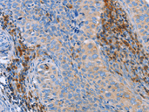 Rabbit Polyclonal Antibody to PLK3
