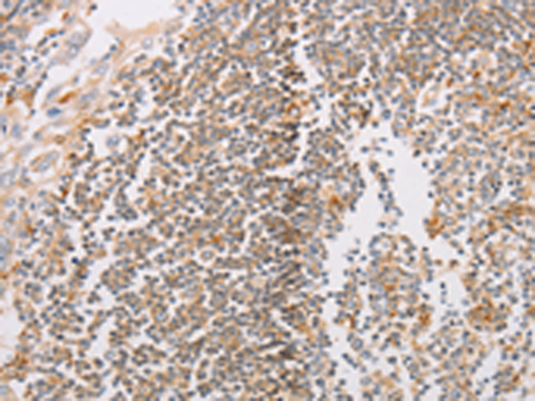 Rabbit Polyclonal Antibody to PACSIN2