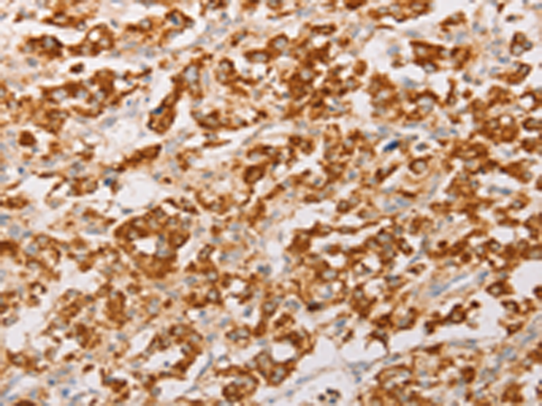Rabbit Polyclonal Antibody to AK2