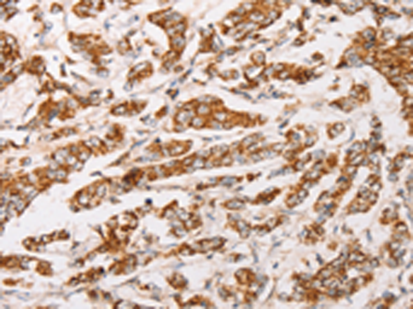 Rabbit Polyclonal Antibody to AK2
