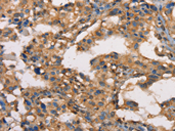 Rabbit Polyclonal Antibody to HK3