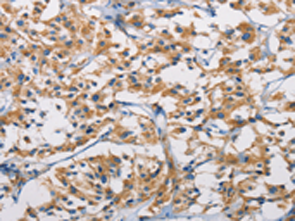 Rabbit Polyclonal Antibody to HK1