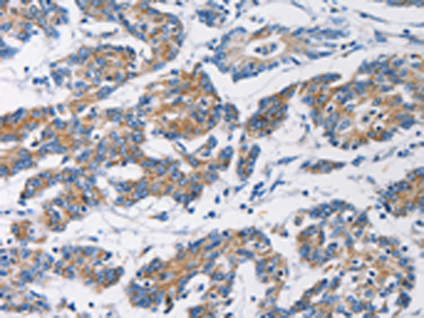 Rabbit Polyclonal Antibody to HK1