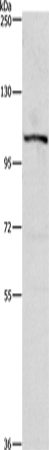 PTK2