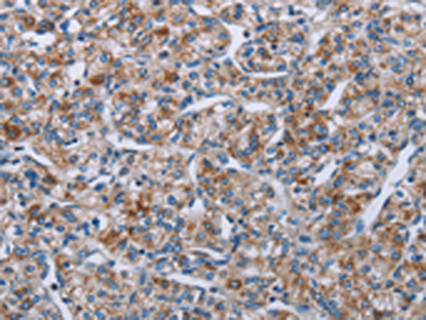 PLCL1