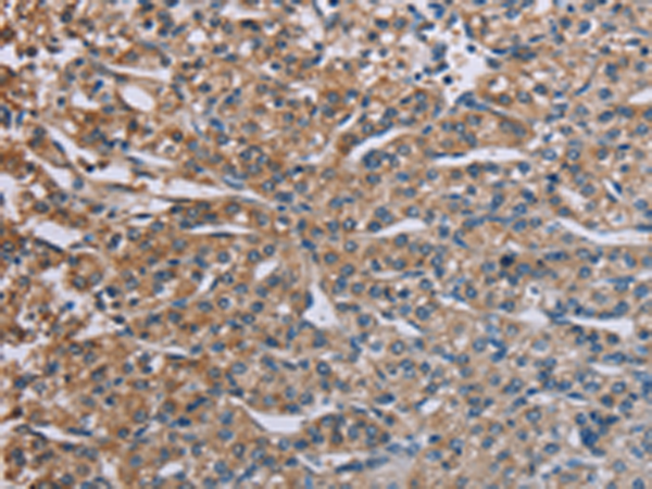 Rabbit Polyclonal Antibody to PLXND1