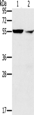PPM1F