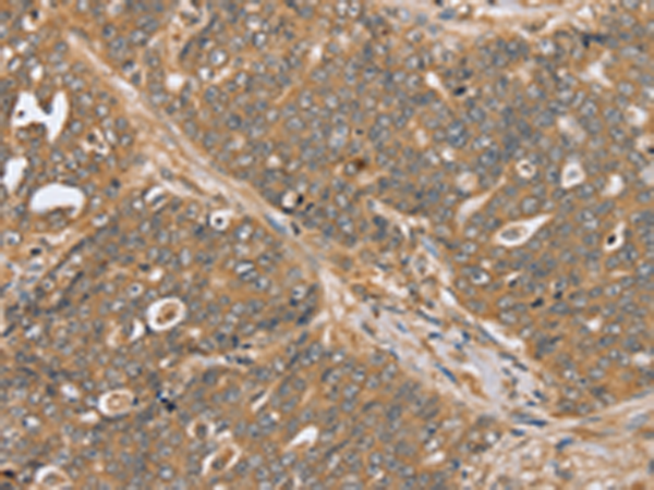 Rabbit Polyclonal Antibody to PTPN20
