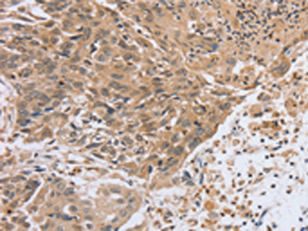 Rabbit Polyclonal Antibody to PTPN4