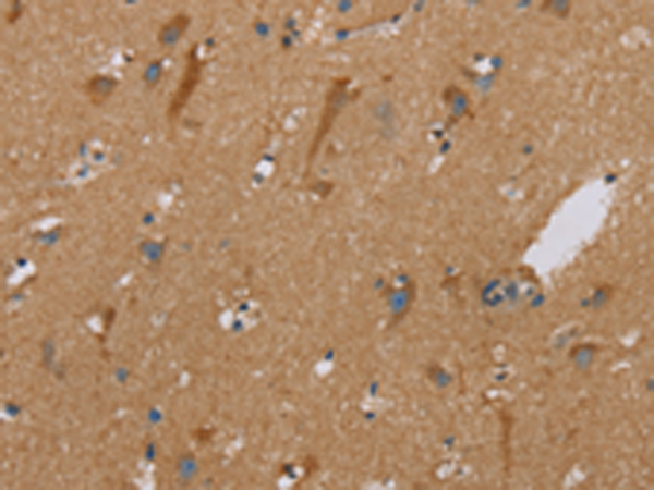 Rabbit Polyclonal Antibody to PUS10