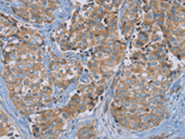 Rabbit Polyclonal Antibody to PUS10