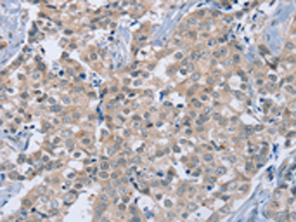 Rabbit Polyclonal Antibody to RAB8B