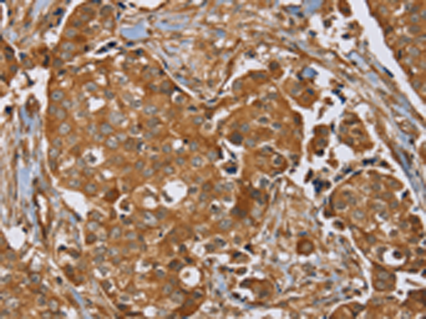 Rabbit Polyclonal Antibody to RAB14