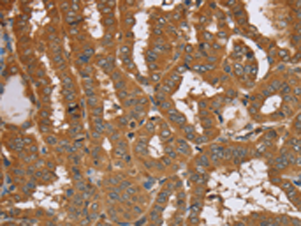 Rabbit Polyclonal Antibody to RAB14