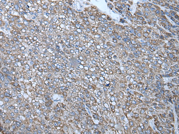 Rabbit Polyclonal Antibody to RAD54B