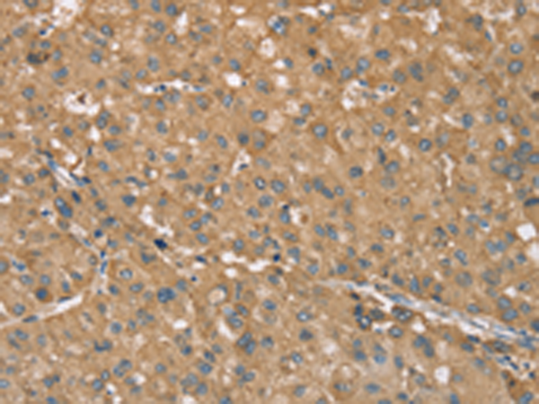 RNF148