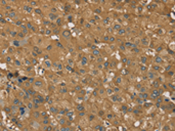 Rabbit Polyclonal Antibody to RORB