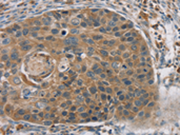 Rabbit Polyclonal Antibody to RORB
