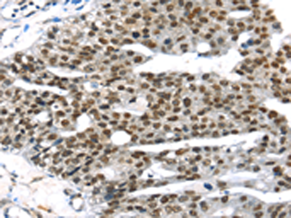 Rabbit Polyclonal Antibody to RRAS