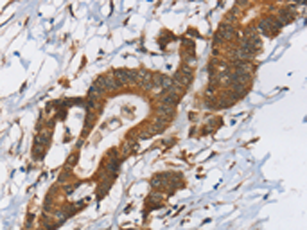 Rabbit Polyclonal Antibody to RPS6KA2