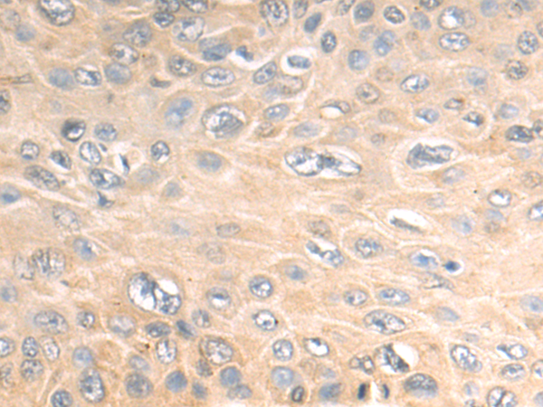 Rabbit Polyclonal Antibody to S100A13