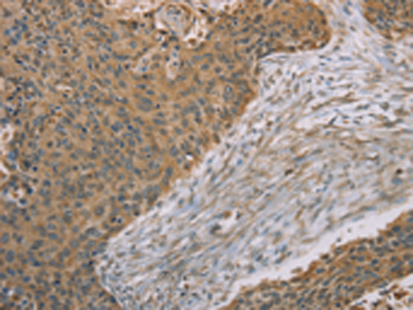 Rabbit Polyclonal Antibody to S100A6