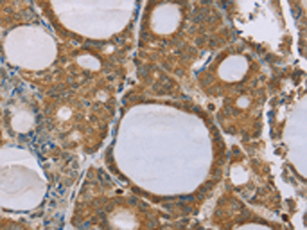 Rabbit Polyclonal Antibody to SAMD4A