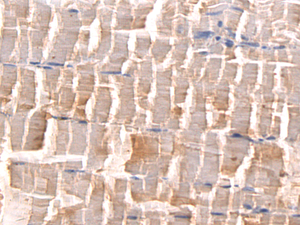 Rabbit Polyclonal Antibody to ACTN2