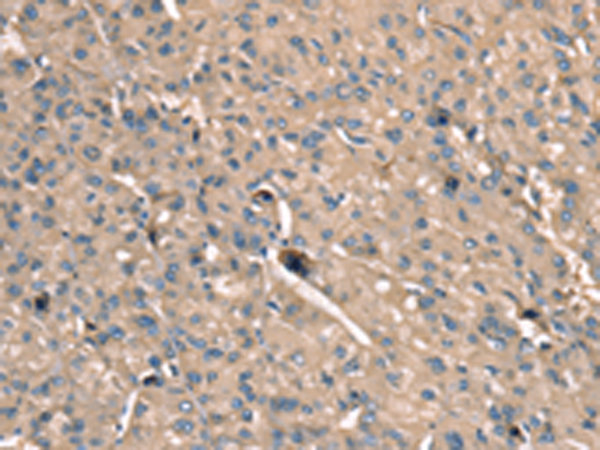 SCN1B