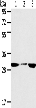 SDHB