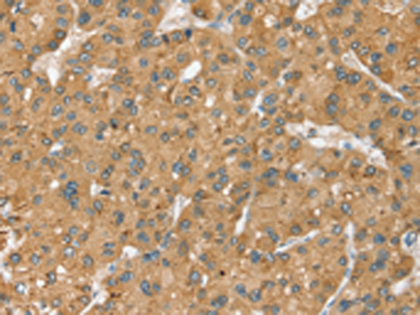 Rabbit Polyclonal Antibody to SEC14L2