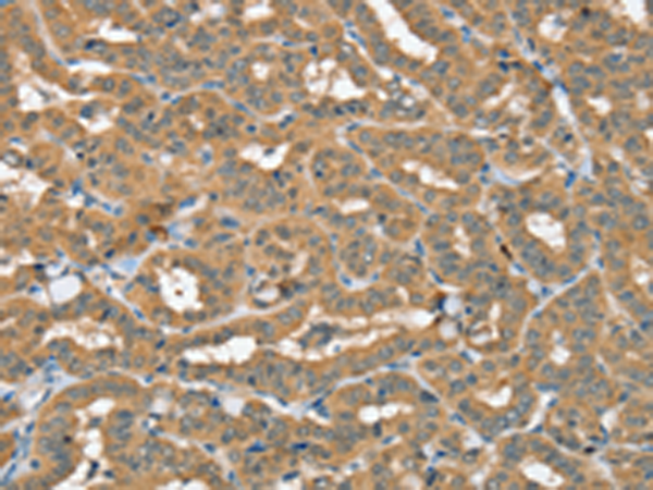 Rabbit Polyclonal Antibody to SEC14L2