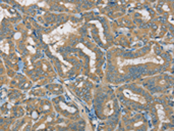 ATP2A3