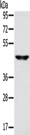 SLC16A8